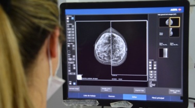 Baradero realizará la "Noche de las Mamografías": dónde y cómo hacer el chequeo