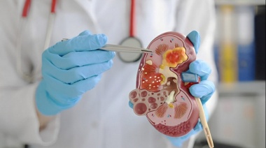 Día Mundial del Riñón: concientización y prevención para proteger la salud renal